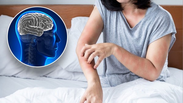 Shingles vaccine has unexpected effect on heart health Shingles vaccine has unexpected effect on heart health