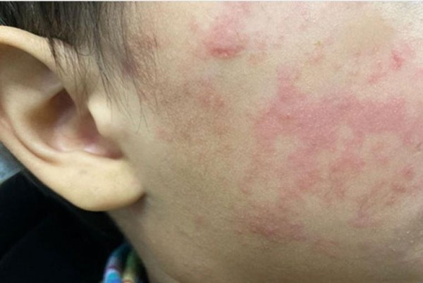 'This should not be happening,' doctor says as measles cases rise to more than 900 in U.S. 'This should not be happening,' doctor says as measles cases rise to more than 900 in U.S.