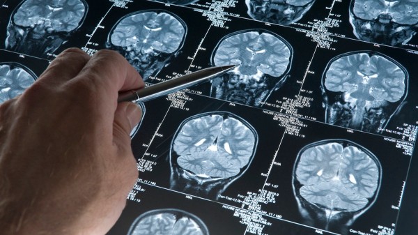 Negative thoughts might be changing your brain in surprising ways, study suggests Negative thoughts might be changing your brain in surprising ways, study suggests