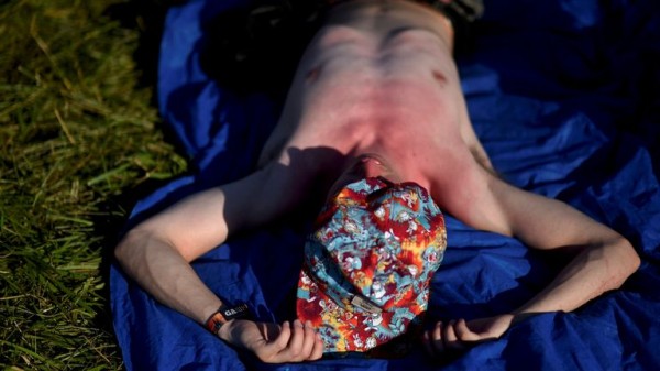 Sunburn isn't just red skin - here's what's happening underneath the burn