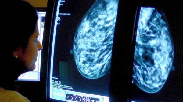 'Transformational' new drug could stop breast cancer tumours before they grow, trial finds