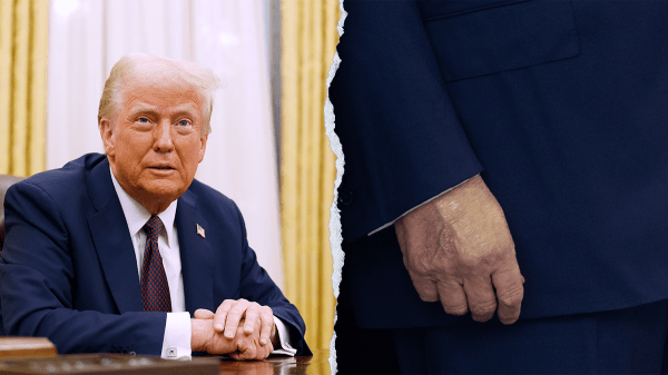 Doctors react to alleged Trump health concerns as photos show swelling and bruising Doctors react to alleged Trump health concerns as photos show swelling and bruising
