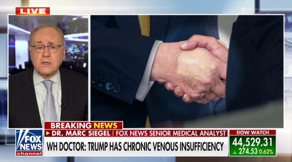 Doctors react to alleged Trump health concerns as photos show swelling and bruising Doctors react to alleged Trump health concerns as photos show swelling and bruising