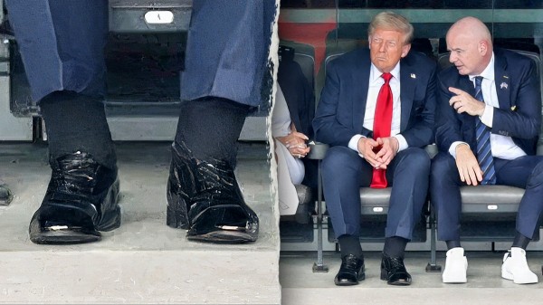Doctors react to alleged Trump health concerns as photos show swelling and bruising Doctors react to alleged Trump health concerns as photos show swelling and bruising