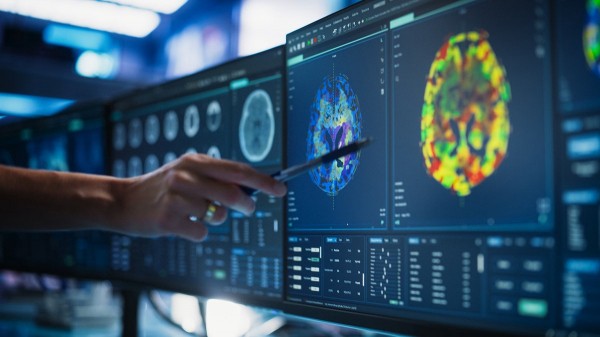 Alzheimer's risk could rise with specific sleep pattern, experts warn Alzheimer's risk could rise with specific sleep pattern, experts warn