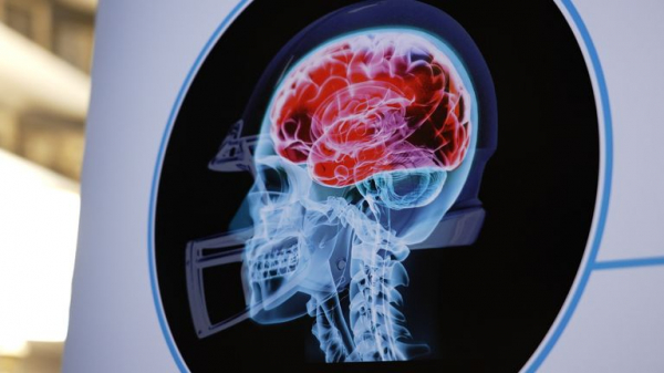 CTE: Brain disease linked to head impacts in sport 'could have contributed' to Manhattan mass shooting CTE: Brain disease linked to head impacts in sport 'could have contributed' to Manhattan mass shooting