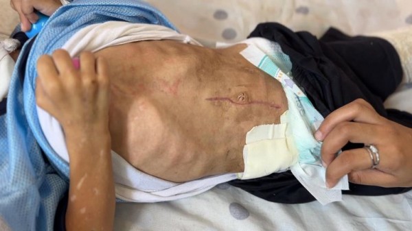 Inside Gaza's Nasser Hospital - where there's virtually no food for malnourished children Inside Gaza's Nasser Hospital - where there's virtually no food for malnourished children