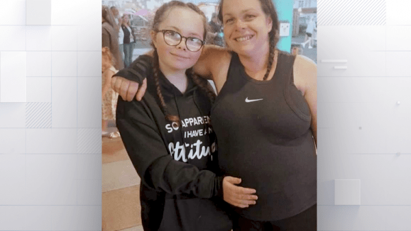 Renae died from a rare brain disease after getting measles as a baby. Now, her mother wants more children to get vaccines Renae died from a rare brain disease after getting measles as a baby. Now, her mother wants more children to get vaccines