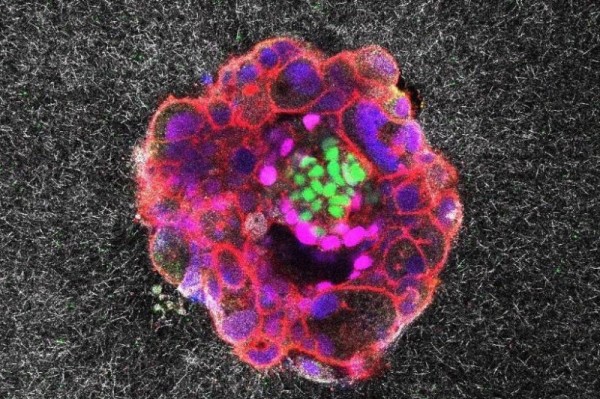 'Astonishing' video shows human embryo implanting in real time