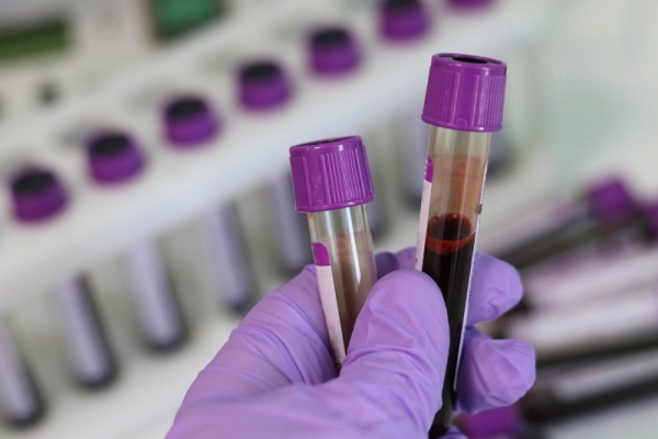 Study shows AI can hone in on genetic risks for 10 inherited diseases