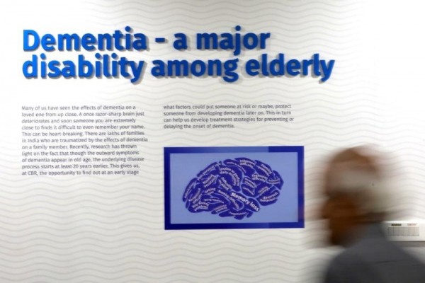 U.K. gene therapy trial effectively treats Huntington's disease U.K. gene therapy trial effectively treats Huntington's disease