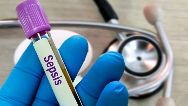 Hidden infection kills millions of children each year as doctors warn of overlooked symptoms Hidden infection kills millions of children each year as doctors warn of overlooked symptoms