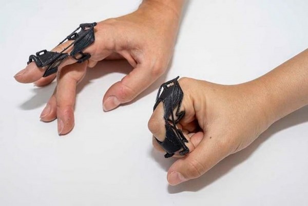 Researchers develop customizable finger brace to ease care Researchers develop customizable finger brace to ease care