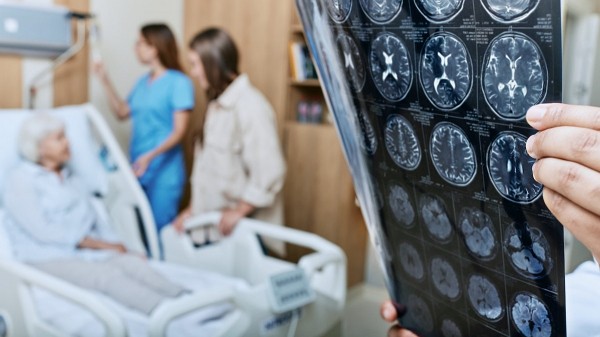Higher stroke risk linked to consuming certain amount of alcohol, study finds Higher stroke risk linked to consuming certain amount of alcohol, study finds