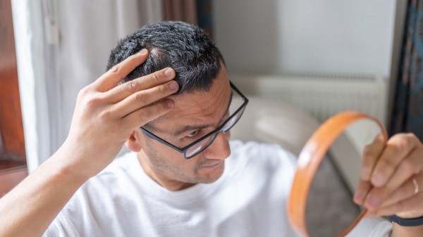 New baldness treatment shows dramatic hair-regrowth gains in major trial New baldness treatment shows dramatic hair-regrowth gains in major trial