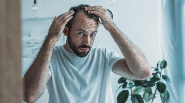 New baldness treatment shows dramatic hair-regrowth gains in major trial New baldness treatment shows dramatic hair-regrowth gains in major trial