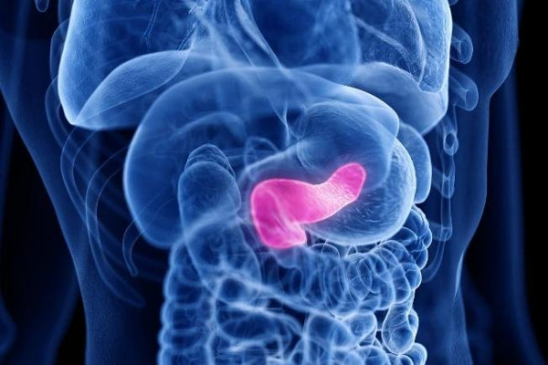 Risk score helps predict pancreatic cancer recurrence, study says Risk score helps predict pancreatic cancer recurrence, study says