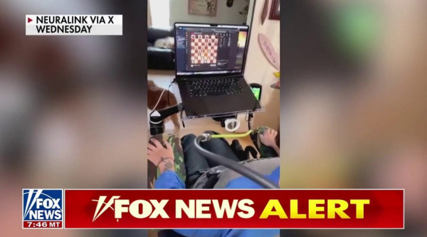 Elon Musk shares plan to mass-produce brain implants for paralysis, neurological disease Elon Musk shares plan to mass-produce brain implants for paralysis, neurological disease