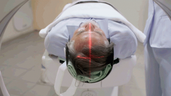 Hidden brain condition may quadruple dementia risk in older adults, study suggests Hidden brain condition may quadruple dementia risk in older adults, study suggests